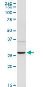 UROS Antibody in Western Blot (WB)