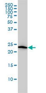 VBP1 Antibody in Western Blot (WB)