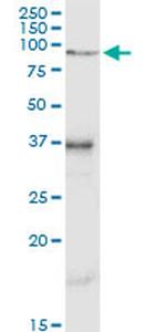 VCAM1 Antibody in Western Blot (WB)