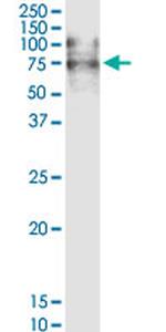 VCAM1 Antibody in Western Blot (WB)