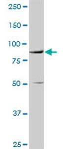 VCAM1 Antibody in Western Blot (WB)