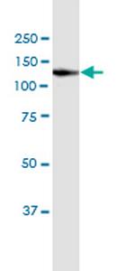 VCL Antibody in Western Blot (WB)