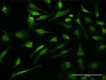 VCP Antibody in Immunocytochemistry (ICC/IF)