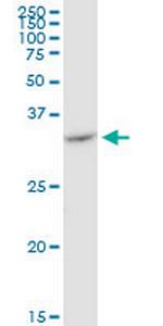 VDAC2 Antibody in Western Blot (WB)