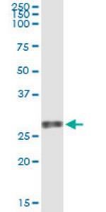 VEGFB Antibody in Immunoprecipitation (IP)