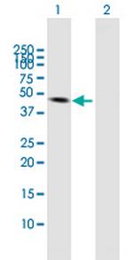 VIL1 Antibody in Western Blot (WB)