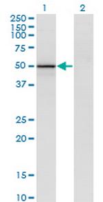 VIL1 Antibody in Western Blot (WB)