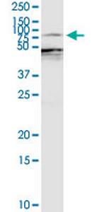 EZR Antibody in Western Blot (WB)