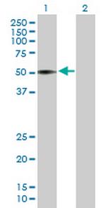 VIPR1 Antibody in Western Blot (WB)