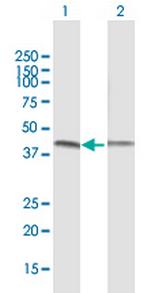 VRK1 Antibody in Western Blot (WB)