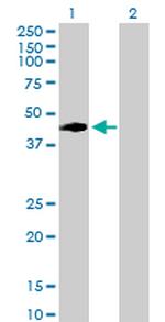 VRK1 Antibody in Western Blot (WB)