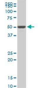 VRK1 Antibody in Western Blot (WB)