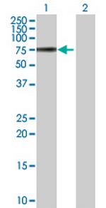 VTN Antibody in Western Blot (WB)