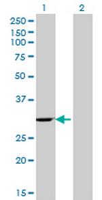 WBSCR1 Antibody in Western Blot (WB)