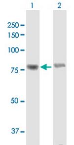 WHSC1 Antibody in Western Blot (WB)