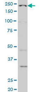 WRN Antibody in Western Blot (WB)