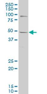 WT1 Antibody in Western Blot (WB)