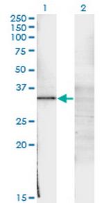 WT1 Antibody in Western Blot (WB)