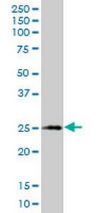 XBP1 Antibody in Western Blot (WB)