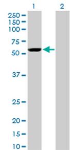 YES1 Antibody in Western Blot (WB)