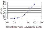 ZFP161 Antibody in ELISA (ELISA)