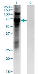 ZNF10 Antibody in Western Blot (WB)