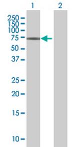 ZNF21 Antibody in Western Blot (WB)