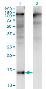 ZBTB16 Antibody in Western Blot (WB)