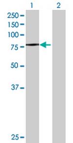 ZNF224 Antibody in Western Blot (WB)