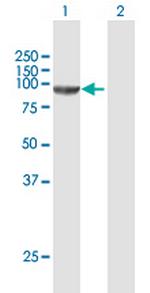 CSDE1 Antibody in Western Blot (WB)