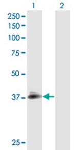 NPHS2 Antibody in Western Blot (WB)