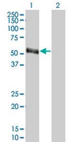 PAX8 Antibody in Western Blot (WB)