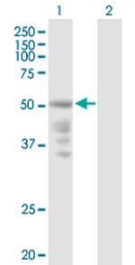 CXCR4 Antibody in Western Blot (WB)