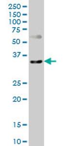 CXCR4 Antibody in Western Blot (WB)