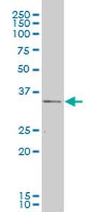 CXCR4 Antibody in Western Blot (WB)