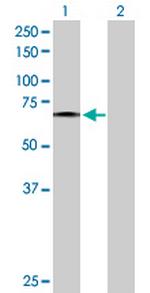 FZD5 Antibody in Western Blot (WB)