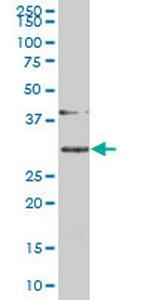 SLBP Antibody in Western Blot (WB)