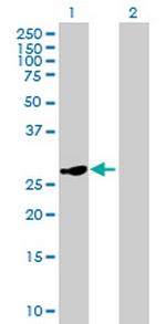 HSD17B8 Antibody in Western Blot (WB)