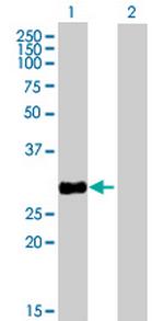 HSD17B8 Antibody in Western Blot (WB)