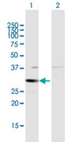 HSD17B8 Antibody in Western Blot (WB)