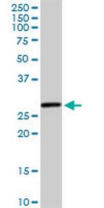 HSD17B8 Antibody in Western Blot (WB)