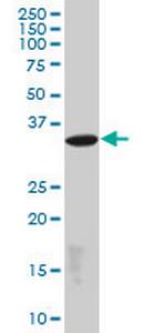 EPM2A Antibody in Western Blot (WB)