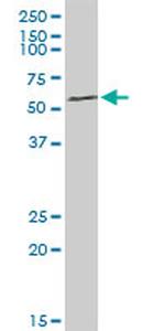 ARHGEF5 Antibody in Western Blot (WB)