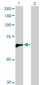 ARHGEF5 Antibody in Western Blot (WB)