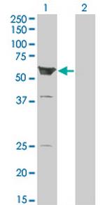 ARHGEF5 Antibody in Western Blot (WB)