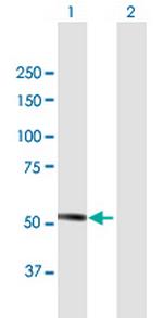 MKKS Antibody in Western Blot (WB)