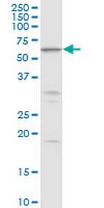 MKKS Antibody in Western Blot (WB)