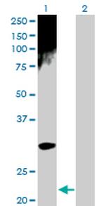 ARD1A Antibody in Western Blot (WB)