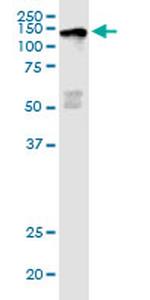 JARID1D Antibody in Western Blot (WB)