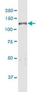 JARID1D Antibody in Western Blot (WB)